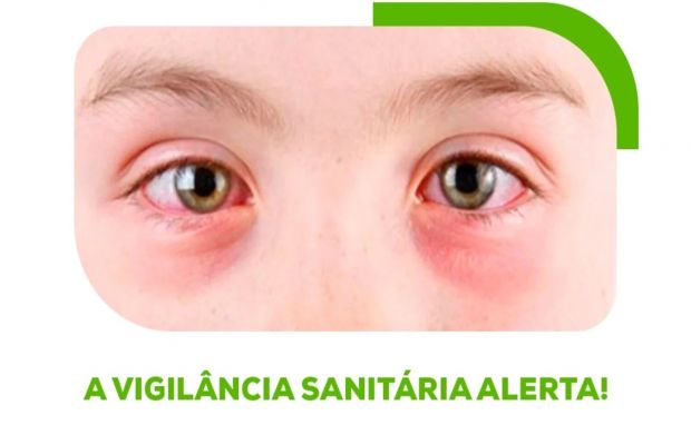 A Vigilância Sanitária Alerta!
